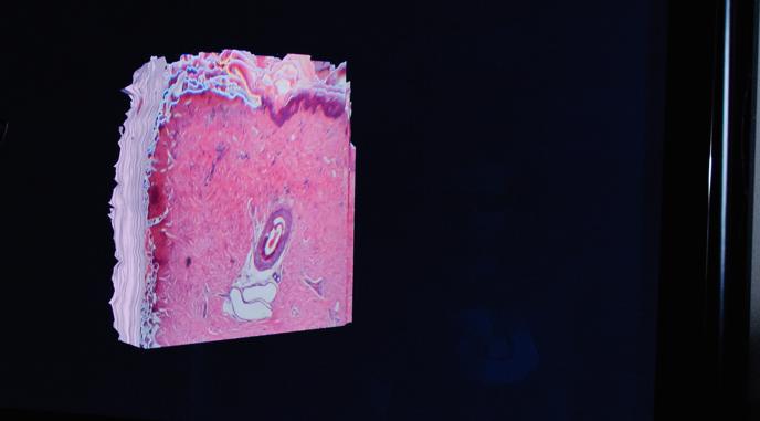 Immunohistochemical Evaluation of Bleeding Control Induced by Holmium Laser and Biolase Dental Laser As Coagulting Devices of Incisional Wounds