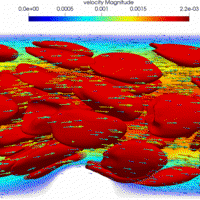 Toward Bi-directional In Situ Visualization and Analysis of Blood Flow Simulations With Dynamic Deforming Walls